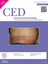 CLINICAL AND EXPERIMENTAL DERMATOLOGY