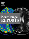 Neuroimage Reports