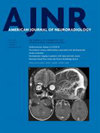 AMERICAN JOURNAL OF NEURORADIOLOGY