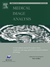 MEDICAL IMAGE ANALYSIS