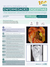 REVISTA ESPANOLA DE ENFERMEDADES DIGESTIVAS